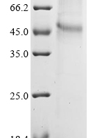 (Tris-Glycine gel) Discontinuous SDS-PAGE (reduced) with 5% enrichment gel and 15% separation gel.