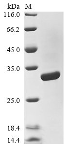 Recombinant Epstein-Barr virus Epstein-Barr nuclear antigen 3 (EBNA3), partial