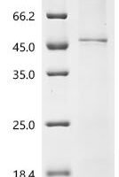 (Tris-Glycine gel) Discontinuous SDS-PAGE (reduced) with 5% enrichment gel and 15% separation gel.