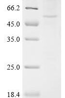 (Tris-Glycine gel) Discontinuous SDS-PAGE (reduced) with 5% enrichment gel and 15% separation gel.