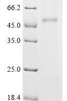 (Tris-Glycine gel) Discontinuous SDS-PAGE (reduced) with 5% enrichment gel and 15% separation gel.