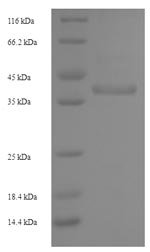 Recombinant Staphylococcus aureus Enterotoxin type G (entG)