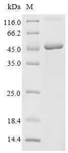Recombinant Simian retrovirus SRV-1 Envelope glycoprotein (env), partial