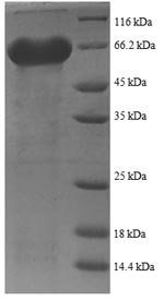 Recombinant Human immunodeficiency virus type 1 group M subtype B Envelope glycoprotein gp160 (env), partial