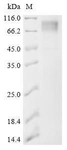 Recombinant Bovine leukemia virus Envelope glycoprotein (env), partial