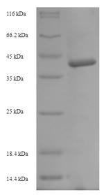 Recombinant Hordeum vulgare Cysteine proteinase EP-B 2 (EPB2)