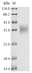 Recombinant Macaca fascicularis Erythropoietin (EPO)