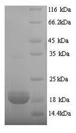 Recombinant Pig Erythropoietin (EPO)