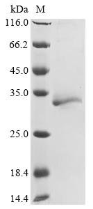 Recombinant Rat Erythropoietin receptor (Epor), partial