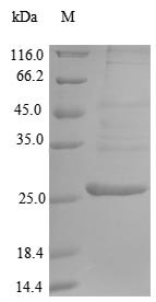 Recombinant Mouse Endoplasmic reticulum aminopeptidase 1 (Erap1), partial
