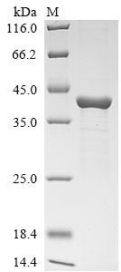 Recombinant Pseudomonas aeruginosa Exotoxin A (eta), partial