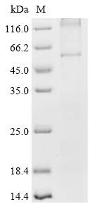 Recombinant Human Frizzled-2 (FZD2) Protein, Homo sapiens (Human), in vitro E.coli expression system, N-terminal10xHis-tagged, 62.6kDa, purity >85% as determined by SDS-PAGE.