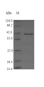 Recombinant Pig Coagulation factor XII (F12), partial