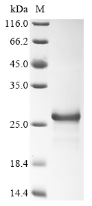 Recombinant Chicken Fibroblast growth factor 2 (FGF2)