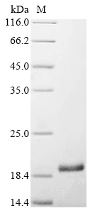 Recombinant Bovine Fibroblast growth factor 2 (FGF2)