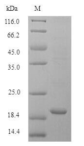 Recombinant Mouse Bis (5'-adenosyl)-triphosphatase (Fhit)