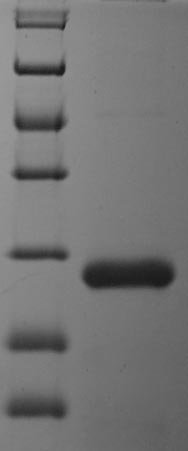 Recombinant Bordetella pertussis Serotype 3 fimbrial subunit (fim3), Bordetella pertussis (strain Tohama I / ATCC BAA-589 / NCTC 13251), E.coli, N-terminal 6xHis-tagged, 23.2kDa, purity >85% as determined by SDS-PAGE.