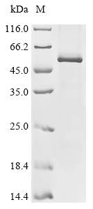 Recombinant Human Activin receptor type-1B (ACVR1B) Protein, Homo sapiens (Human), in vitro E.coli expression system, N-terminal 10xHis-tagged, 56.1kDa, purity >85% as determined by SDS-PAGE.