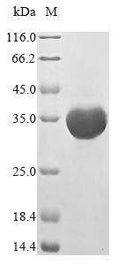 Recombinant Mouse Formyl peptide receptor 2 (Fpr2), partial, Mus musculus (Mouse), E.coli, N-terminal 10xHis-GST-tagged and C-terminal Myc-tagged, 33.3kDa, purity >85% as determined by SDS-PAGE.