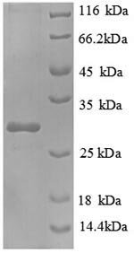 Recombinant Escherichia coli NAD (P)H-flavin reductase (fre)