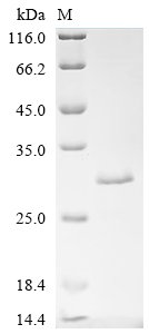 Recombinant Cat Ferritin light chain (FTL)