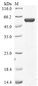 Recombinant Vesicular stomatitis Indiana virus Glycoprotein G (G), partial, Vesicular stomatitis Indiana virus (strain Mudd-Summers) (VSIV), E.coli, N-terminal 10xHis-tagged and C-terminal Myc-tagged, 54.8kDa, purity >85% as determined by SDS-PAGE.