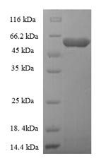 Recombinant Rabies virus Glycoprotein (G), partial