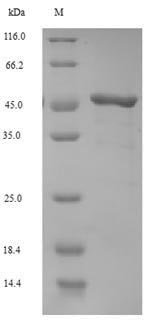Recombinant Moloney murine leukemia virus Gag polyprotein (gag), partial, Moloney murine leukemia virus (isolate Shinnick) (MoMLV), E.coli, N-terminal 6xHis-SUMO-tagged, 46.6kDa, purity >90% as determined by SDS-PAGE.