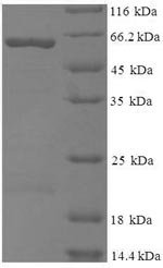 Recombinant Moloney murine leukemia virus Gag polyprotein (gag), partial, Moloney murine leukemia virus (isolate Shinnick) (MoMLV), E.coli, N-terminal GST-tagged, 57.6kDa, purity >90% as determined by SDS-PAGE.