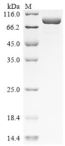 Recombinant Chicken Glyceraldehyde-3-phosphate dehydrogenase (GAPDH), partial, Biotinylated, Gallus gallus (Chicken), E.coli, N-terminal MBP-tagged and C-terminal 6xHis-Avi-tagged, 83.3kDa, purity >90% as determined by SDS-PAGE.