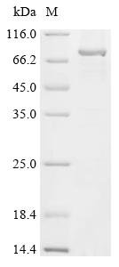 Recombinant Mouse Polypeptide N-acetylgalactosaminyltransferase 3 (Galnt3) Protein, Mus musculus (Mouse), in vitro E.coli expression system, N-terminal 10xHis-tagged, 74.5kDa, purity >85% as determined by SDS-PAGE.