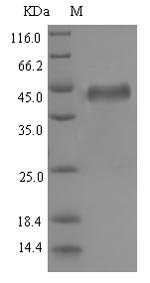 Recombinant Epstein-Barr virus Envelope glycoprotein B (gB), partial
