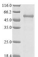 (Tris-Glycine gel) Discontinuous SDS-PAGE (reduced) with 5% enrichment gel and 15% separation gel.
