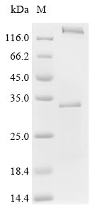 Recombinant Human herpesvirus 6A Envelope glycoprotein H (gH), partial, Human herpesvirus 6A (strain Uganda-1102) (HHV-6 variant A) (Human B lymphotropic virus), E.coli, N-terminal 6xHis-SUMO-tagged, 29.6kDa, purity >90% as determined by SDS-PAGE.