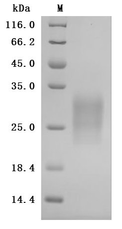 Recombinant Rat Gastric inhibitory polypeptide receptor (Gipr), partial (Active), Rattus norvegicus (Rat), Mammalian cell, C-terminal 10xHis-tagged, 14.9kDa, purity >95% as determined by SDS-PAGE.