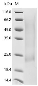 Recombinant Rat Gastric inhibitory polypeptide receptor (Gipr), partial, Rattus norvegicus (Rat), Yeast, N-terminal 6xHis-tagged, 15.5kDa, purity >95% as determined by SDS-PAGE.