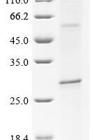 (Tris-Glycine gel) Discontinuous SDS-PAGE (reduced) with 5% enrichment gel and 15% separation gel.