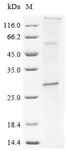 Recombinant Human CD9 antigen (CD9) Protein, Homo sapiens (Human), in vitro E.coli expression system, N-terminal 10xHis-tagged, 31.3kDa, purity >85% as determined by SDS-PAGE.