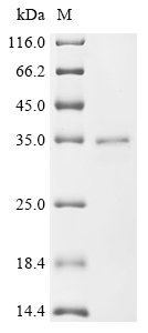 Recombinant Human herpesvirus 2 Envelope glycoprotein L (gL), Human herpesvirus 2 (strain HG52) (HHV-2) (Human herpes simplex virus 2), E.coli, C-terminal 6xHis-tagged, 30.5kDa, purity >85% as determined by SDS-PAGE.