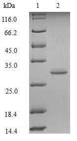 Recombinant Mouse Glucagon-like peptide 1 receptor (Glp1r), partial, Mus musculus (Mouse), E.coli, N-terminal 6xHis-SUMO-tagged, 30.4kDa, purity >90% as determined by SDS-PAGE.