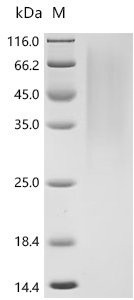 Recombinant Mouse Glucagon-like peptide 1 receptor(Glp1r), partial