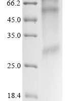 (Tris-Glycine gel) Discontinuous SDS-PAGE (reduced) with 5% enrichment gel and 15% separation gel.