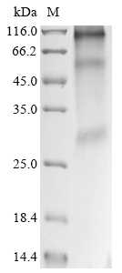 Recombinant Human CD63 antigen (CD63) Protein, Homo sapiens (Human), in vitro E.coli expression system, N-terminal 10xHis-tagged, 31.5kDa, purity >90% as determined by SDS-PAGE.