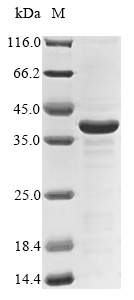 Recombinant Lake Victoria marburgvirus Envelope glycoprotein (GP), partial, Lake Victoria marburgvirus (strain Popp-67) (MARV) (Marburg virus (strain West Germany/Popp/1967)), E.coli, N-terminal 10xHis-tagged and C-terminal Myc-tagged, 34.3kDa, purity >85% as determined by SDS-PAGE.