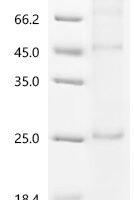(Tris-Glycine gel) Discontinuous SDS-PAGE (reduced) with 5% enrichment gel and 15% separation gel.
