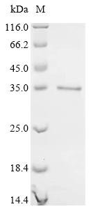 Recombinant Lymphocytic choriomeningitis virus Pre-glycoprotein polyprotein GP complex (GPC), Partial, Lymphocytic choriomeningitis virus (strain Armstrong) (LCMV), E.coli, C-terminal 6xHis-tagged, 33.3kDa, purity >90% as determined by SDS-PAGE.