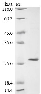 Recombinant Lymphocytic choriomeningitis virus Pre-glycoprotein polyprotein GP complex (GPC), partial, Lymphocytic choriomeningitis virus (strain WE) (LCMV), E.coli, C-terminal 6xHis-tagged, 24.3kDa, purity >90% as determined by SDS-PAGE.