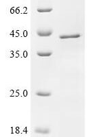(Tris-Glycine gel) Discontinuous SDS-PAGE (reduced) with 5% enrichment gel and 15% separation gel.