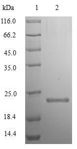 Recombinant Toxoplasma gondii Dense granule protein 1 (GRA1)