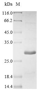Recombinant Rat Gremlin-1 (Grem1), Rattus norvegicus (Rat), Baculovirus, N-terminal 10xHis-tagged and C-terminal Myc-tagged, 22.2kDa, purity >85% as determined by SDS-PAGE.